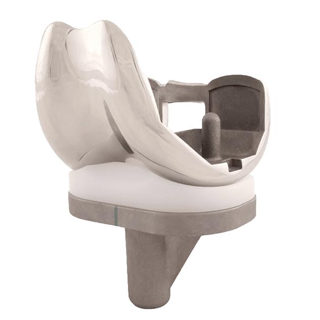 1- Total Knee Replacement Systems
